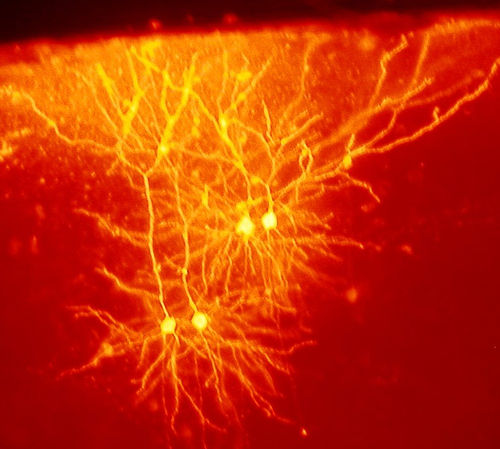 Skórzane neurony!